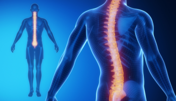 Spine disease in the ageing population