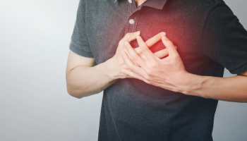 Heart attack with normal epicardial coronary arteries