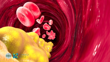 Lipid lowering therapy: What is new