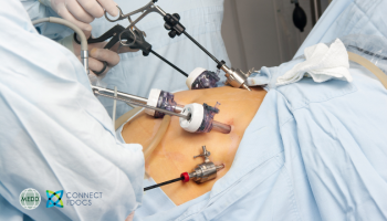 Bariatric Surgery- Practical advice to GPs looking after bariatric patients