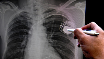 Factors associated with cardiac implantable electronic device‐related infections