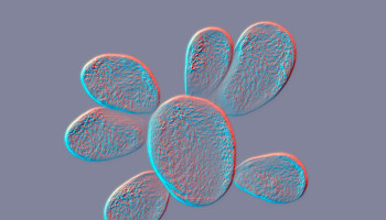 Paracoccidioidomycosis: an Australian case
