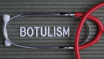 Botulism: a mimic for brainstem strokes and Miller Fisher syndrome
