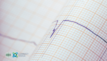 Atrial Fibrillation Rate vs Rhythm Control: When to chase sinus rhythm vs when to accept AF.