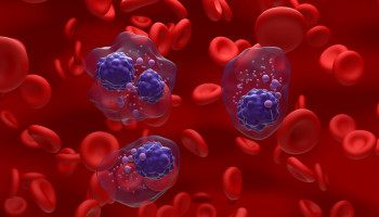 Multiple myeloma incidence, mortality, and prevalence estimates and projections, Australia