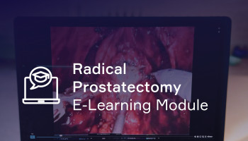 IMRA Robotic Radical Prostatectomy Online