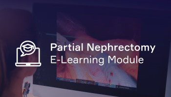 Robotic Assisted Partial Nephrectomy Online