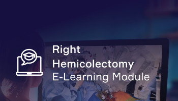 Robotic Assisted Right Hemicolectomy Online