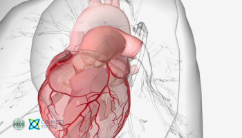 Structural heart disease