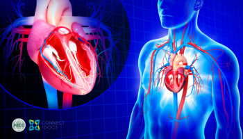 Clipping the Tricuspid Valve