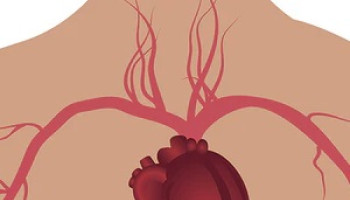 Coronary Artery Disease Outcome Improvement Activity