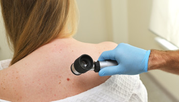 What is behind the declining incidence of melanoma in younger Australians?