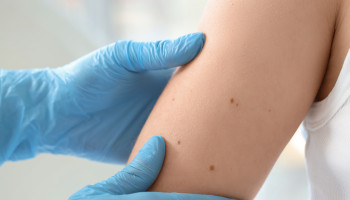 Towards evidence‐based skin checks