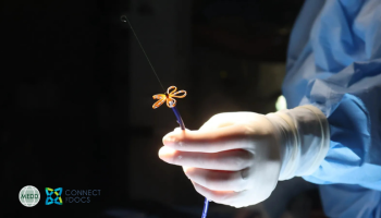 AF Ablation State of the Art: Pulsed Field Ablation