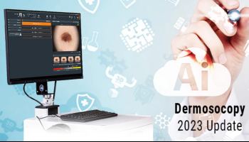 Artificial and human intelligence in Dermoscopy