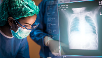 Prolonged SARS‐CoV‐2 shedding in a lung transplant recipient: time for flexibility