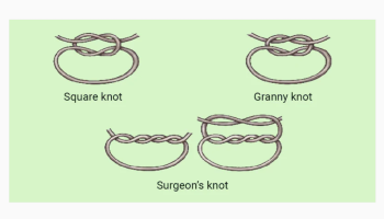 Suturing and perfecting the ellipse plus local anaesthetic