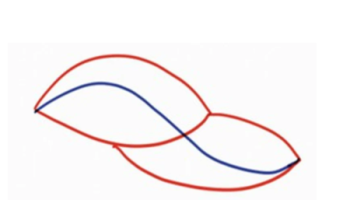 Neurovascular island flaps