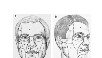 Tips and Tricks revisited for Skin Cancer Surgery