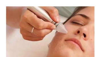 Introduction to chemical peels