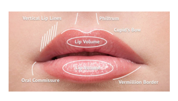 Introduction to dermal filler techniques
