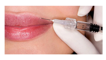 Advanced dermal fillers