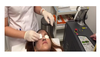 Lasers: Pigment conditions