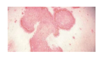 General Dermatology cases