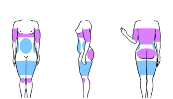 Common modalities for non-surgical body shaping