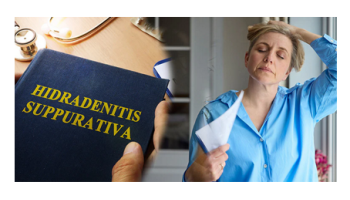 From Acne Inversa to Common Menopausal Problems: Women's Health Issues