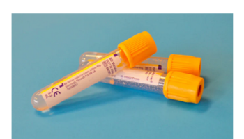 Sexually Transmitted Infections and Cervical Screening