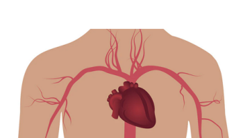Coronary Artery Disease