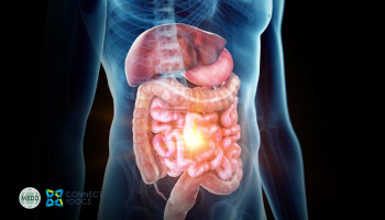 Updates in the management of inflammatory bowel disease: A Growing Problem