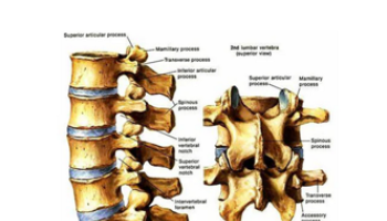 Low back pain