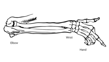 Elbow, wrist and hand problems