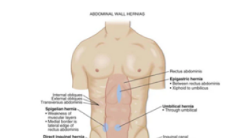 Abdominal wall and groin problems