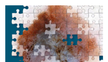 Welcome and introduction to Dermatopathology Correlation cases