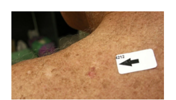 Non-melanocytic lesions Part 2