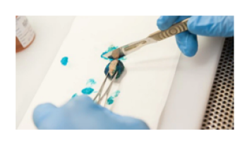 Specimen processing: Does the type of biopsy make a difference? Correlation cases