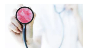 Basic principles of applying dermoscopy in general dermatology