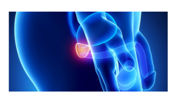 Prostate conditions and prostate check