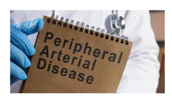 Peripheral arterial disease in men