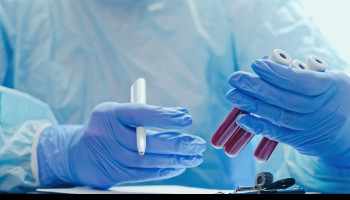 Updating the diagnosis and management of elevated serum ferritin levels in the era of routine ferrit