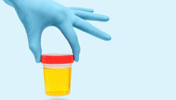Exploring the role of urine drug screening in opioid agonist therapy