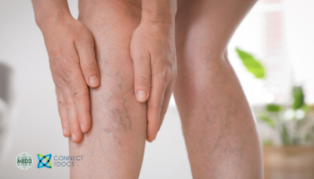 Vascular Health- conditions, treatments and surgery