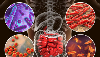 Oral Health: Long-Duration Space Missions