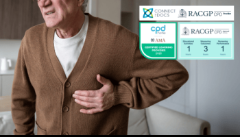 Management of Atrial Fibrillation