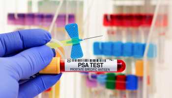 MJA Podcast: Modern paradigms for prostate cancer detection and management