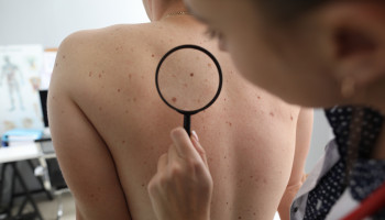 The diagnosis and initial management of melanoma in Australia