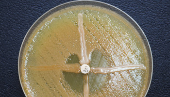 Carbapenemase‐producing Enterobacterales: a profound threat to Australian public health